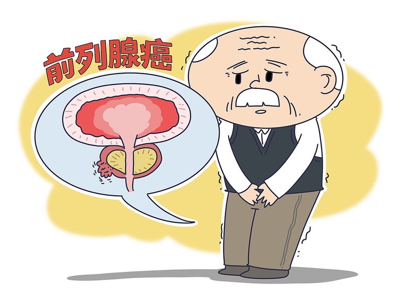 拜登罹患前列腺癌在我国初诊早期患者不足四成，筛查意识薄弱、诊断技术局限